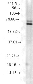 HSP70 / Heat Shock Protein 70 Antibody - Hsp70 (5A5), Rat lysate.  This image was taken for the unconjugated form of this product. Other forms have not been tested.