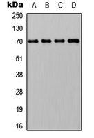 HSP70 / Heat Shock Protein 70 Antibody - Western blot analysis of HSP70 expression in HepG2 (A); Jurkat (B); Raw264.7 (C); PC12 (D) whole cell lysates.