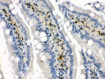 HSP70 / Heat Shock Protein 70 Antibody