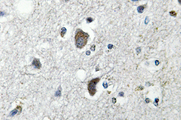 HSP70 / Heat Shock Protein 70 Antibody - IHC of HSP 70 (F245) pAb in paraffin-embedded human brain tissue.