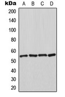 HSP70L1 / HSPA14 Antibody - Western blot analysis of HSPA14 expression in K562 (A); HeLa (B); NIH3T3 (C); rat kidney (D) whole cell lysates.