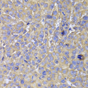 HSP70L1 / HSPA14 Antibody - Immunohistochemistry of paraffin-embedded mouse cancer tissue.