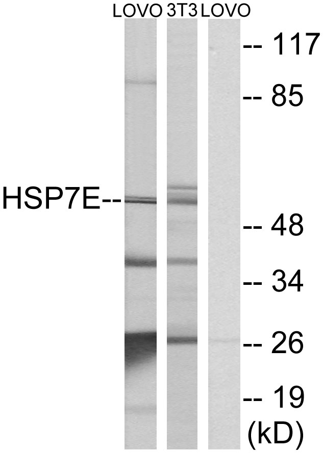 HSP70L1 / HSPA14 Antibody - Western blot analysis of lysates from LOVO cells and NIH/3T3 cells, using HSP7E Antibody. The lane on the right is blocked with the synthesized peptide.