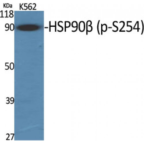 HSP90 Beta Antibody - Western blot of Phospho-HSP90beta (S254) antibody