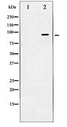 HSP90 Beta Antibody - Western blot of HSP90B expression in TNF-a treated HeLa whole cell lysates,The lane on the left is treated with the antigen-specific peptide.