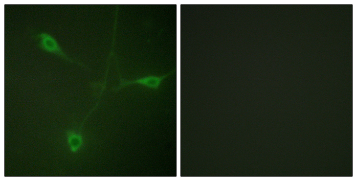 HSP90 Beta Antibody - Immunofluorescence analysis of NIH/3T3 cells, using HSP90B (Phospho-Ser226) Antibody. The picture on the right is blocked with the phospho peptide.