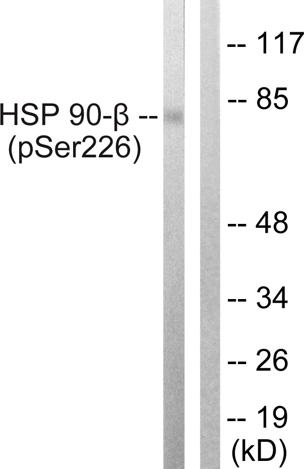 HSP90 Beta Antibody - Western blot analysis of lysates from A549 cells treated with serum 20% 15', using HSP90B (Phospho-Ser226) Antibody. The lane on the right is blocked with the phospho peptide.