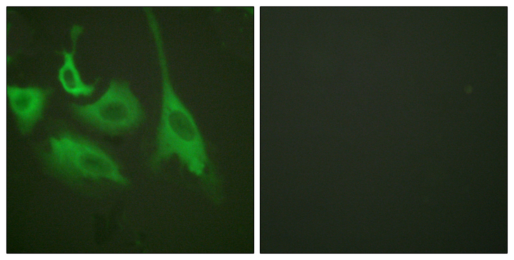 HSP90 Beta Antibody - Immunofluorescence analysis of HeLa cells treated with TNF-a 20nM 15', using HSP90B (Phospho-Ser254) Antibody. The picture on the right is blocked with the phospho peptide.