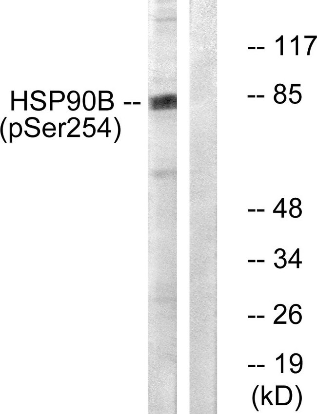 HSP90 Beta Antibody - Western blot analysis of lysates from HeLa cells treated with TNF-a 10ng/ml 30', using HSP90B (Phospho-Ser254) Antibody. The lane on the right is blocked with the phospho peptide.