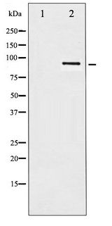 HSP90 Beta Antibody - Western blot of HSP90B phosphorylation expression in TNF-a treated HeLa whole cell lysates,The lane on the left is treated with the antigen-specific peptide.