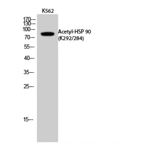 HSP90 / Heat Shock Protein 90 Antibody - Western blot of Acetyl-HSP 90 (K292/284) antibody