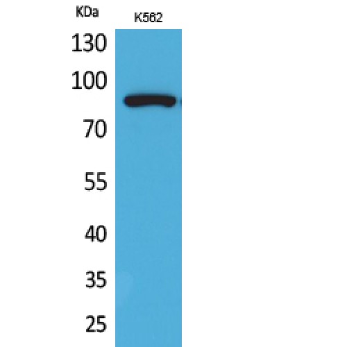 HSP90 / Heat Shock Protein 90 Antibody - Western blot of Acetyl-HSP 90 (K292/284) antibody