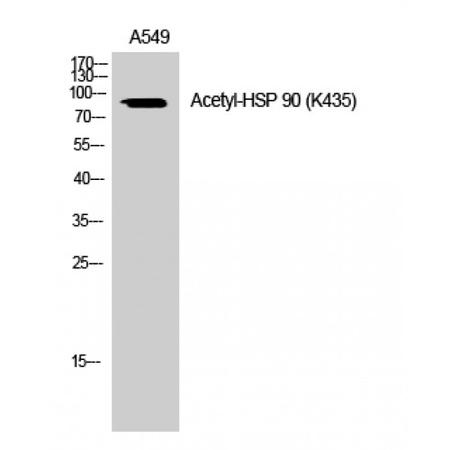 HSP90 / Heat Shock Protein 90 Antibody - Western blot of Acetyl-HSP 90 (K435) antibody using A459 cells.