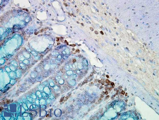 HSP90 / Heat Shock Protein 90 Antibody - IHC staining of inflammatory cells and epithelia mucosa in mouse colon tissues.  This image was taken for the unconjugated form of this product. Other forms have not been tested.