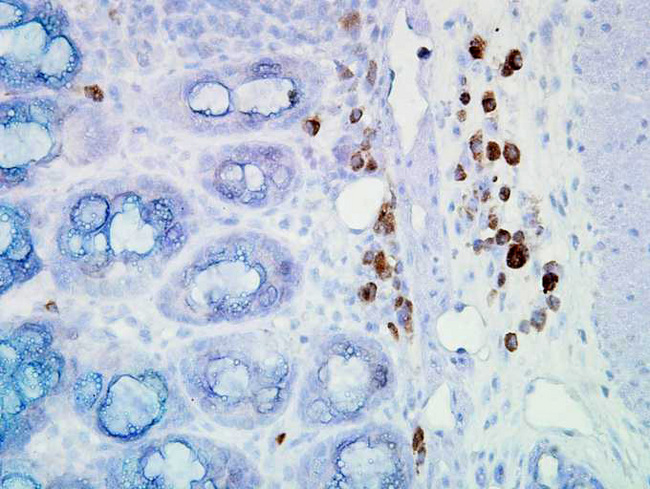 HSP90 / Heat Shock Protein 90 Antibody - Hsp90 (D7alpha), Mouse colon carcinoma.  This image was taken for the unconjugated form of this product. Other forms have not been tested.