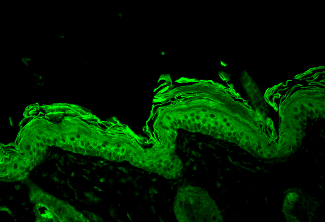 HSP90 / Heat Shock Protein 90 Antibody - Hsp90, Mouse back skin.