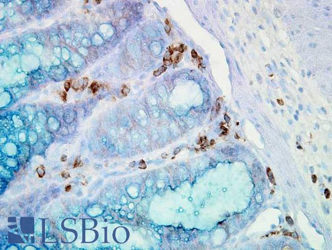 HSP90AA / HSP90 Alpha Antibody - IHC staining of inflammatory cells in mouse colon tissue.  This image was taken for the unconjugated form of this product. Other forms have not been tested.