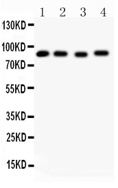 HSP90AA1 / Hsp90 Alpha A1 Antibody - Hsp90 antibody Western blot. All lanes: Anti-HSP90 at 0.5 ug/ml. Lane 1: Rat Liver Tissue Lysate at 40 ug. Lane 2: HeLa Whole Cell Lysate at 40 ug. Lane 3: MCF-7 Whole Cell Lysate at 40 ug. Lane 4: Raji Whole Cell Lysate at 40 ug. Predicted band size: 83 kD. Observed band size: 83 kD.