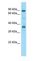 HSP90AA1 / Hsp90 Alpha A1 Antibody - HSP90AA1 / Hsp90 antibody Western Blot of Mouse Thymus.  This image was taken for the unconjugated form of this product. Other forms have not been tested.