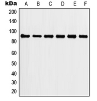 HSP90AA1 / Hsp90 Alpha A1 Antibody - Western blot analysis of HSP90 alpha expression in MCF7 (A); HeLa (B); NIH3T3 (C); C6 (D); mouse liver (E); rat liver (F) whole cell lysates.