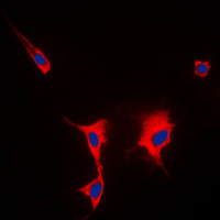 HSP90AA1 / Hsp90 Alpha A1 Antibody - Immunofluorescent analysis of HSP90 alpha staining in HeLa cells. Formalin-fixed cells were permeabilized with 0.1% Triton X-100 in TBS for 5-10 minutes and blocked with 3% BSA-PBS for 30 minutes at room temperature. Cells were probed with the primary antibody in 3% BSA-PBS and incubated overnight at 4 C in a humidified chamber. Cells were washed with PBST and incubated with a DyLight 594-conjugated secondary antibody (red) in PBS at room temperature in the dark. DAPI was used to stain the cell nuclei (blue).