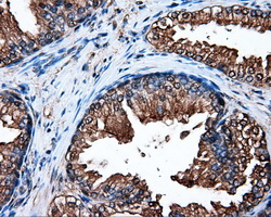 HSP90AA1 / Hsp90 Alpha A1 Antibody - Immunohistochemical staining of paraffin-embedded prostate tissue using anti-HSP90AA1 mouse monoclonal antibody. (Dilution 1:50).