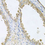 HSP90AA1 / Hsp90 Alpha A1 Antibody - Immunohistochemistry of paraffin-embedded human prostate using HSP90AA1 antibody at dilution of 1:100 (40x lens).