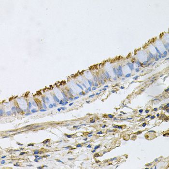 HSP90AA1 / Hsp90 Alpha A1 Antibody - Immunohistochemistry of paraffin-embedded human lung using HSP90AA1 antibody at dilution of 1:100 (40x lens).