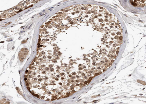 HSP90AA1 / Hsp90 Alpha A1 Antibody - 1:100 staining human Testis tissue by IHC-P. The tissue was formaldehyde fixed and a heat mediated antigen retrieval step in citrate buffer was performed. The tissue was then blocked and incubated with the antibody for 1.5 hours at 22°C. An HRP conjugated goat anti-rabbit antibody was used as the secondary.