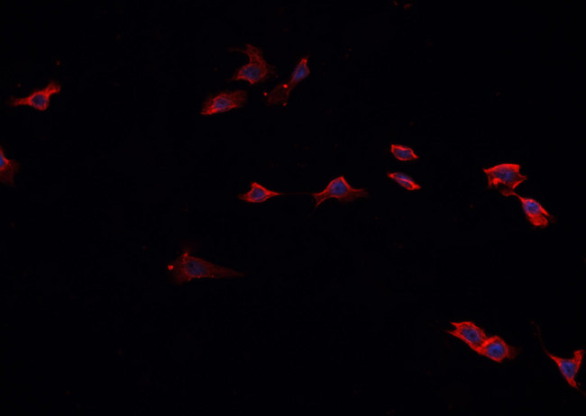 HSP90AA1 / Hsp90 Alpha A1 Antibody - Staining NIH-3T3 cells by IF/ICC. The samples were fixed with PFA and permeabilized in 0.1% Triton X-100, then blocked in 10% serum for 45 min at 25°C. The primary antibody was diluted at 1:200 and incubated with the sample for 1 hour at 37°C. An Alexa Fluor 594 conjugated goat anti-rabbit IgG (H+L) Ab, diluted at 1/600, was used as the secondary antibody.