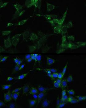 HSP90AA1 / Hsp90 Alpha A1 Antibody - Immunofluorescence analysis of NIH/3T3 cells using HSP90AA1 Polyclonal Antibody at dilution of 1:100.Blue: DAPI for nuclear staining.