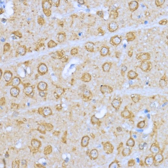 HSP90AA1 / Hsp90 Alpha A1 Antibody - Immunohistochemistry of paraffin-embedded Rat brain using HSP90AA1 Polyclonal Antibody at dilution of 1:200 (40x lens).