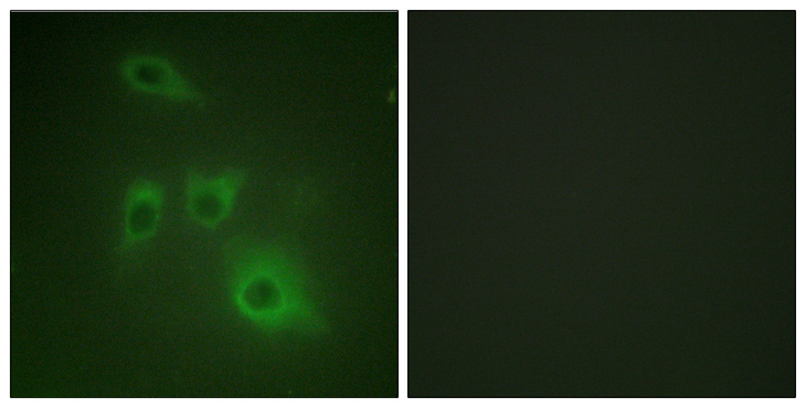 HSP90AB1 / HSP90 Alpha B1 Antibody - Immunofluorescence analysis of HUVEC cells, using HSP90B Antibody. The picture on the right is blocked with the synthesized peptide.