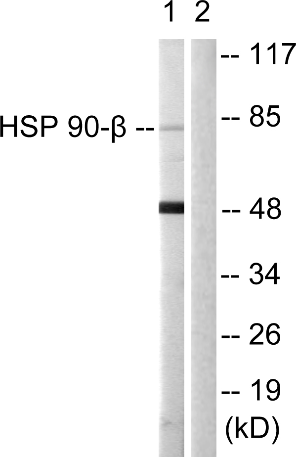 HSP90AB1 / HSP90 Alpha B1 Antibody - Western blot analysis of lysates from 293 cells, using HSP90B Antibody. The lane on the right is blocked with the synthesized peptide.