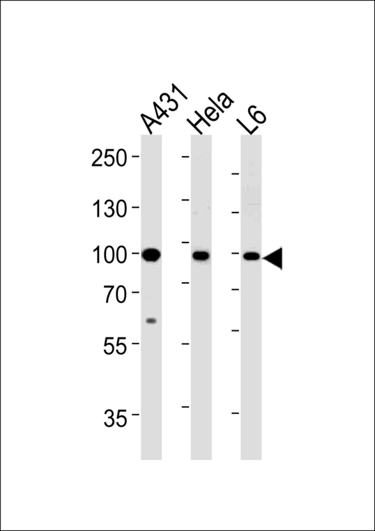 HSP90AB1 / HSP90 Alpha B1 Antibody - HSP90AB1 Antibody western blot of A431,HeLa,L6 cell line lysates (35 ug/lane). The HSP90AB1 antibody detected the HSP90AB1 protein (arrow).