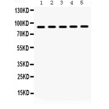 HSP90AB1 / HSP90 Alpha B1 Antibody - Hsp90 beta antibody Western blot. All lanes: Anti Hsp90 beta at 0.5 ug/ml. Lane 1: Rat Testis Tissue Lysate at 50 ug. Lane 2: Rat Thymus Tissue Lysate at 50 ug. Lane 3: Human Placenta Tissue Lysate at 50 ug. Lane 4: SW620 Whole Cell Lysate at 40 ug. Lane 5: HELA Whole Cell Lysate at 40 ug. Predicted band size: 90 kD. Observed band size: 90 kD.