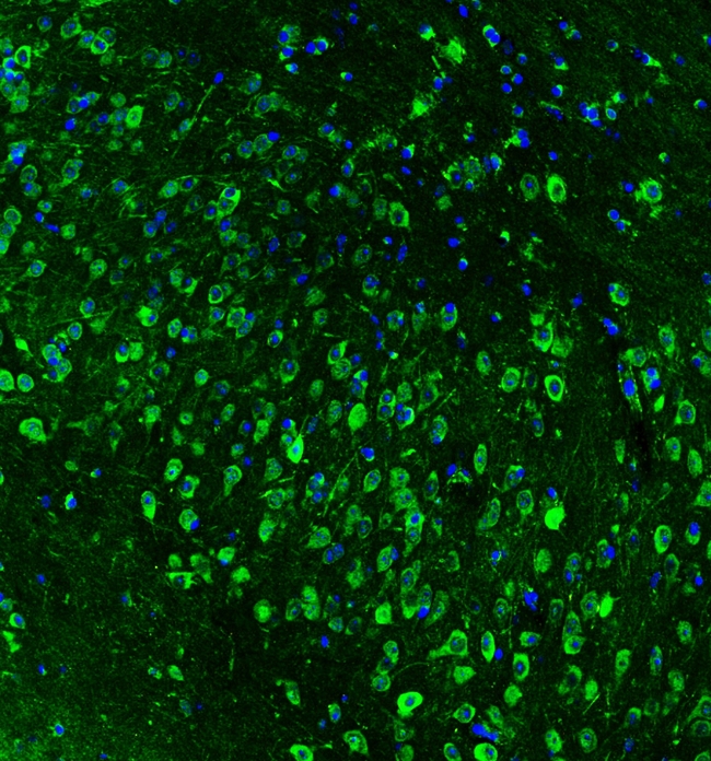 HSP90AB1 / HSP90 Alpha B1 Antibody - IF analysis of HSP90AB1 using anti-HSP90AB1 antibody HSP90AB1 was detected in paraffin-embedded section of mouse brain tissues. Heat mediated antigen retrieval was performed in citrate buffer (pH6, epitope retrieval solution ) for 20 mins. The tissue section was blocked with 10% goat serum. The tissue section was then incubated with 2µg/mL rabbit anti-HSP90AB1 Antibody overnight at 4°C. DyLight®488 Conjugated Goat Anti-Rabbit IgG was used as secondary antibody at 1:100 dilution and incubated for 30 minutes at 37°C. The section was counterstained with DAPI. Visualize using a fluorescence microscope and filter sets appropriate for the label used.