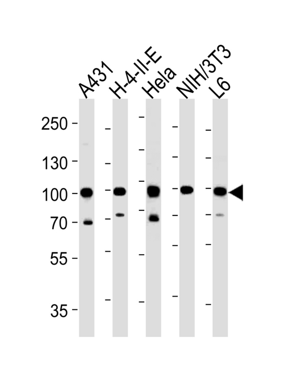 HSP90AB1 / HSP90 Alpha B1 Antibody - HSP90AB1 Antibody western blot of A431,H-4-II-E,HeLa,mouse NIH/3T3,rat L6 cell line lysates (35 ug/lane). The HSP90AB1 antibody detected the HSP90AB1 protein (arrow).