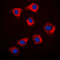 HSP90AB1 / HSP90 Alpha B1 Antibody - Immunofluorescent analysis of HSP90 beta staining in MCF7 cells. Formalin-fixed cells were permeabilized with 0.1% Triton X-100 in TBS for 5-10 minutes and blocked with 3% BSA-PBS for 30 minutes at room temperature. Cells were probed with the primary antibody in 3% BSA-PBS and incubated overnight at 4 deg C in a humidified chamber. Cells were washed with PBST and incubated with a DyLight 594-conjugated secondary antibody (red) in PBS at room temperature in the dark. DAPI was used to stain the cell nuclei (blue).