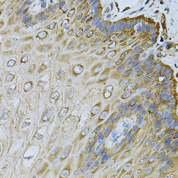 HSP90AB1 / HSP90 Alpha B1 Antibody - Immunohistochemistry of paraffin-embedded human esophagus using HSP90AB1 Antibodyat dilution of 1:100 (40x lens).