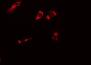 HSP90AB1 / HSP90 Alpha B1 Antibody - Staining HeLa cells by IF/ICC. The samples were fixed with PFA and permeabilized in 0.1% Triton X-100, then blocked in 10% serum for 45 min at 25°C. The primary antibody was diluted at 1:200 and incubated with the sample for 1 hour at 37°C. An Alexa Fluor 594 conjugated goat anti-rabbit IgG (H+L) antibody, diluted at 1/600, was used as secondary antibody.