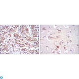 HSP90AB1 / HSP90 Alpha B1 Antibody - Immunohistochemistry (IHC) analysis of paraffin-embedded kidney cancer tissues (left) and brain tissues (right) with DAB staining using HSP90beta Monoclonal Antibody.