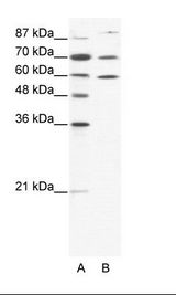 HSP90AB1 / HSP90 Alpha B1 Antibody - A: Marker, B: HepG2 Cell Lysate.  This image was taken for the unconjugated form of this product. Other forms have not been tested.