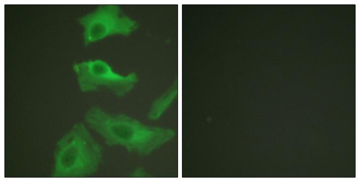 HSP90AB1 / HSP90 Alpha B1 Antibody - TNF-a + - Immunofluorescence analysis of HeLa cells, treated with TNF-a (20nM, 15mins), using HSP90B (Ab-254) antibody.