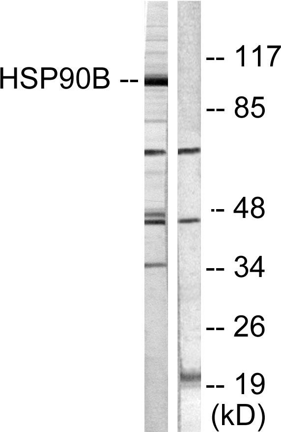 HSP90AB1 / HSP90 Alpha B1 Antibody - Western blot analysis of extracts from Hela cells treated with TNF-a (20ng/ml, 30min), using HSP90B (Ab-254) antibody ( Line 1 and 2).