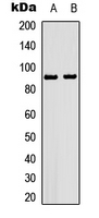 HSP90AB1 / HSP90 Alpha B1 Antibody - Western blot analysis of HSP90 beta (pS226) expression in L929 (A); Raw264.7 (B) whole cell lysates.