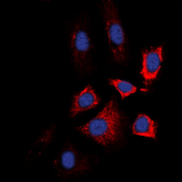 HSP90AB1 / HSP90 Alpha B1 Antibody - Immunofluorescent analysis of HSP90 beta (pS226) staining in L929 cells. Formalin-fixed cells were permeabilized with 0.1% Triton X-100 in TBS for 5-10 minutes and blocked with 3% BSA-PBS for 30 minutes at room temperature. Cells were probed with the primary antibody in 3% BSA-PBS and incubated overnight at 4 ??C in a humidified chamber. Cells were washed with PBST and incubated with a DyLight 594-conjugated secondary antibody (red) in PBS at room temperature in the dark. DAPI was used to stain the cell nuclei (blue).