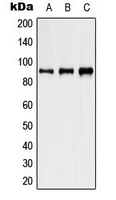 HSP90AB1 / HSP90 Alpha B1 Antibody - Western blot analysis of HSP90 beta (pS254) expression in HeLa heat shocked-treated (A); NIH3T3 heat shocked-treated (B); PC12 heat shocked-treated (C) whole cell lysates.