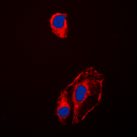 HSP90AB1 / HSP90 Alpha B1 Antibody - Immunofluorescent analysis of HSP90 beta (pS254) staining in HeLa cells. Formalin-fixed cells were permeabilized with 0.1% Triton X-100 in TBS for 5-10 minutes and blocked with 3% BSA-PBS for 30 minutes at room temperature. Cells were probed with the primary antibody in 3% BSA-PBS and incubated overnight at 4 C in a humidified chamber. Cells were washed with PBST and incubated with a DyLight 594-conjugated secondary antibody (red) in PBS at room temperature in the dark. DAPI was used to stain the cell nuclei (blue).