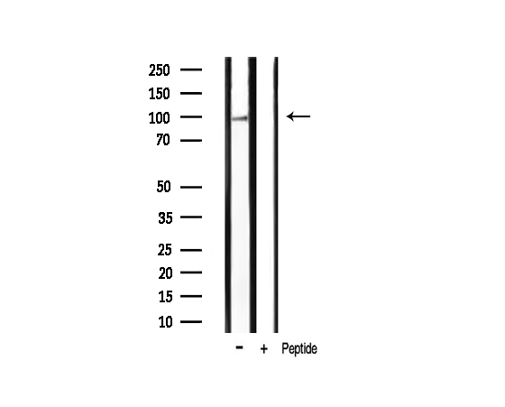 HSP90AB1 / HSP90 Alpha B1 Antibody - Western blot analysis of HSP90B phosphorylation expression in mouse brain tissue lysates. The lane on the right is treated with the antigen-specific peptide.